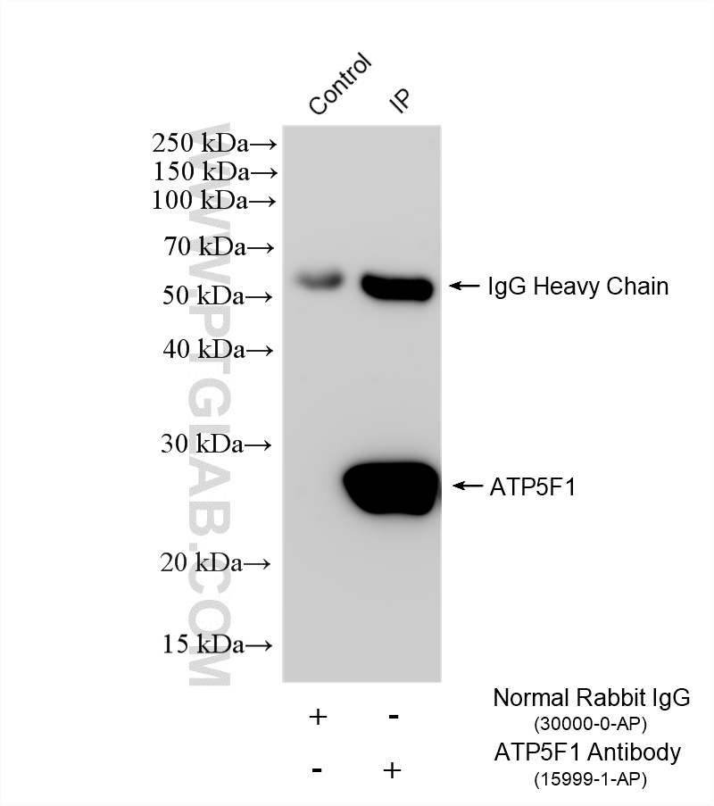 IP experiment of HEK-293T using 15999-1-AP