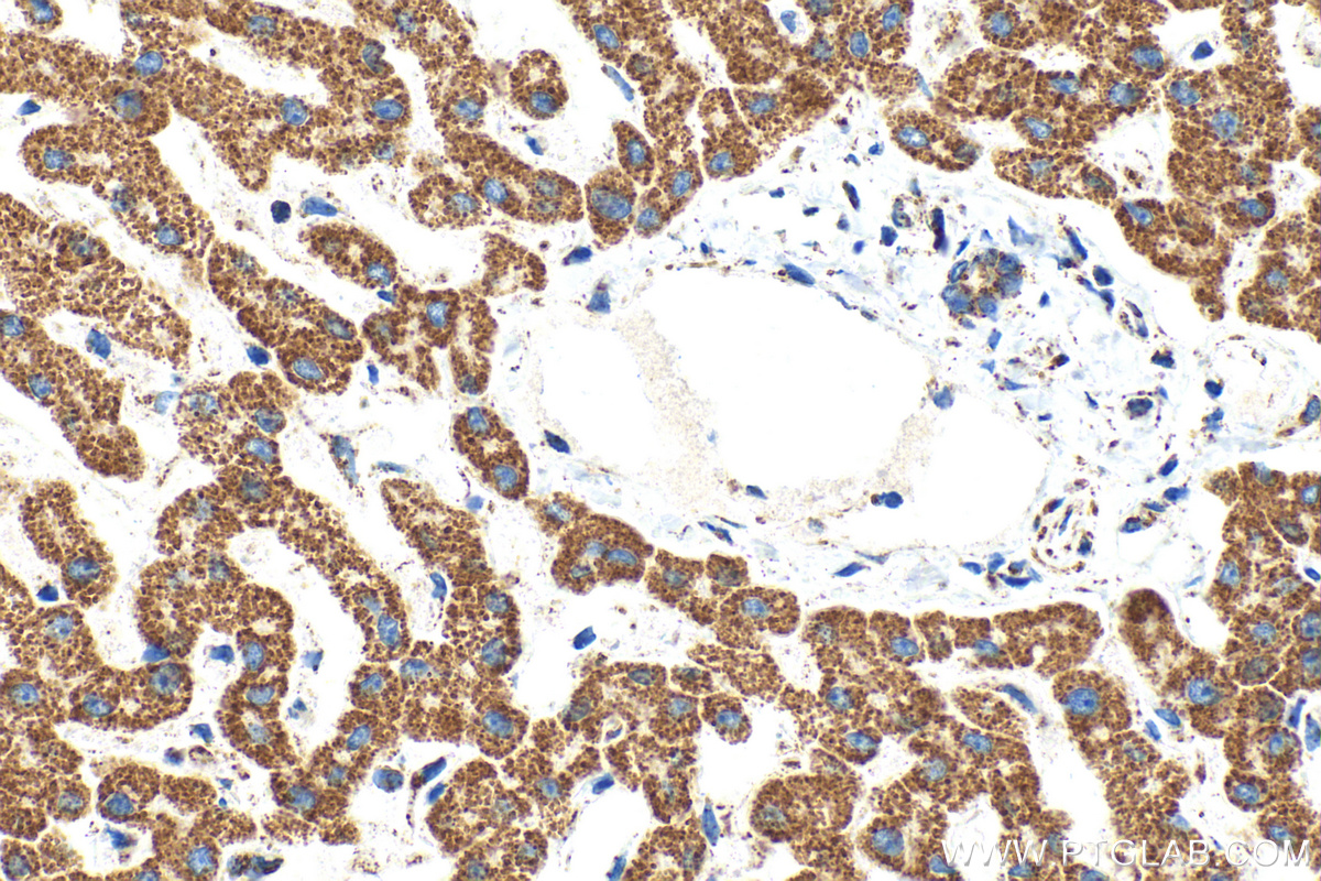 IHC staining of human liver using 68304-1-Ig
