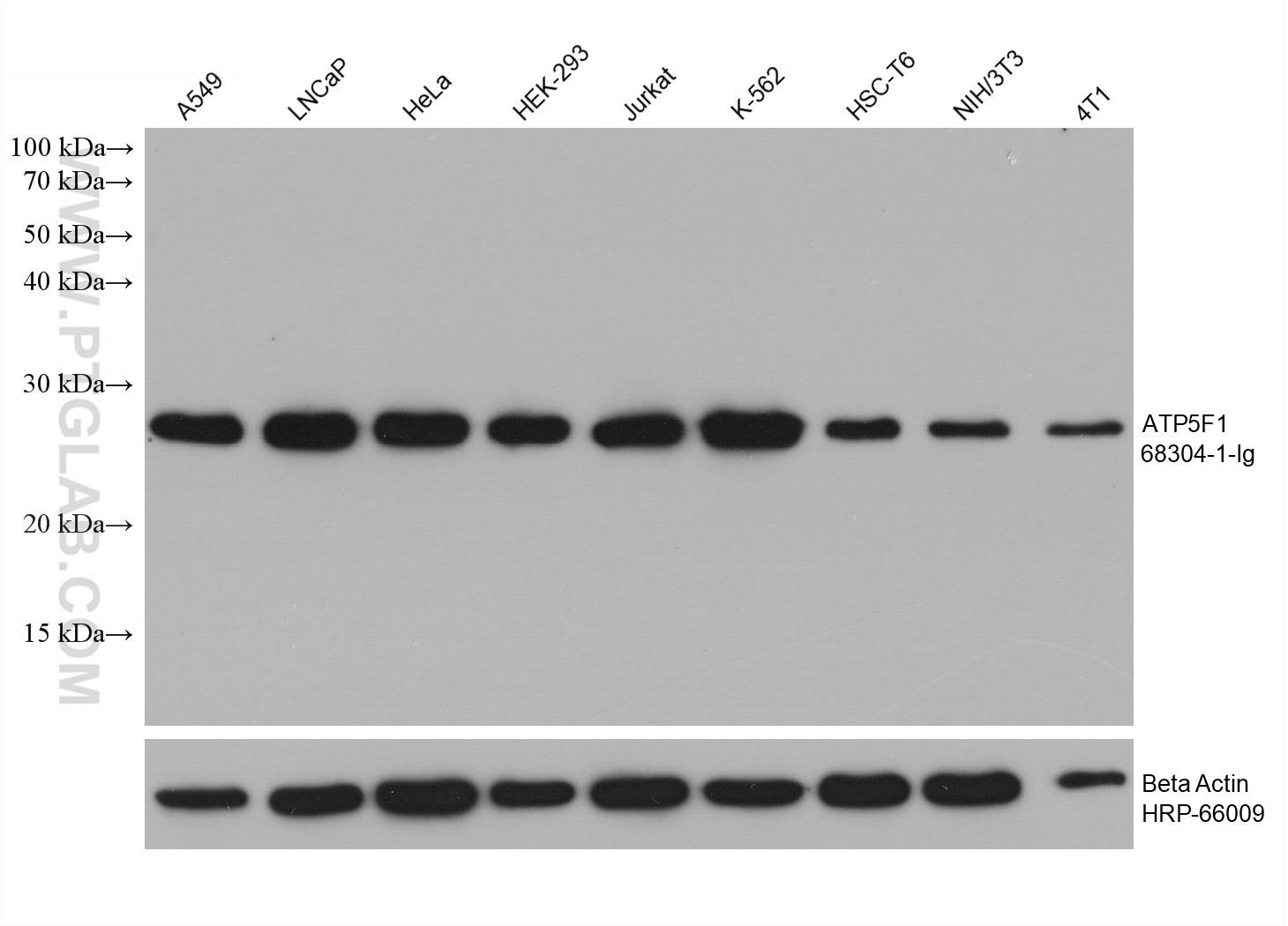 ATP5F1