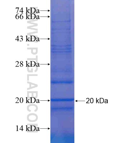 ATP5G1 fusion protein Ag20933 SDS-PAGE ATP5G1 fusion protein Ag20933 SDS-PAGE
