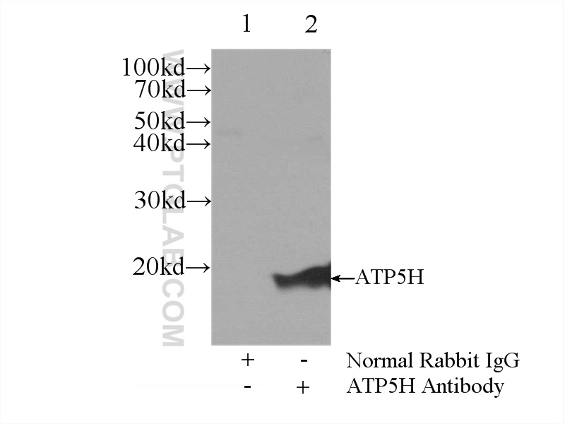 IP experiment of mouse liver using 17589-1-AP