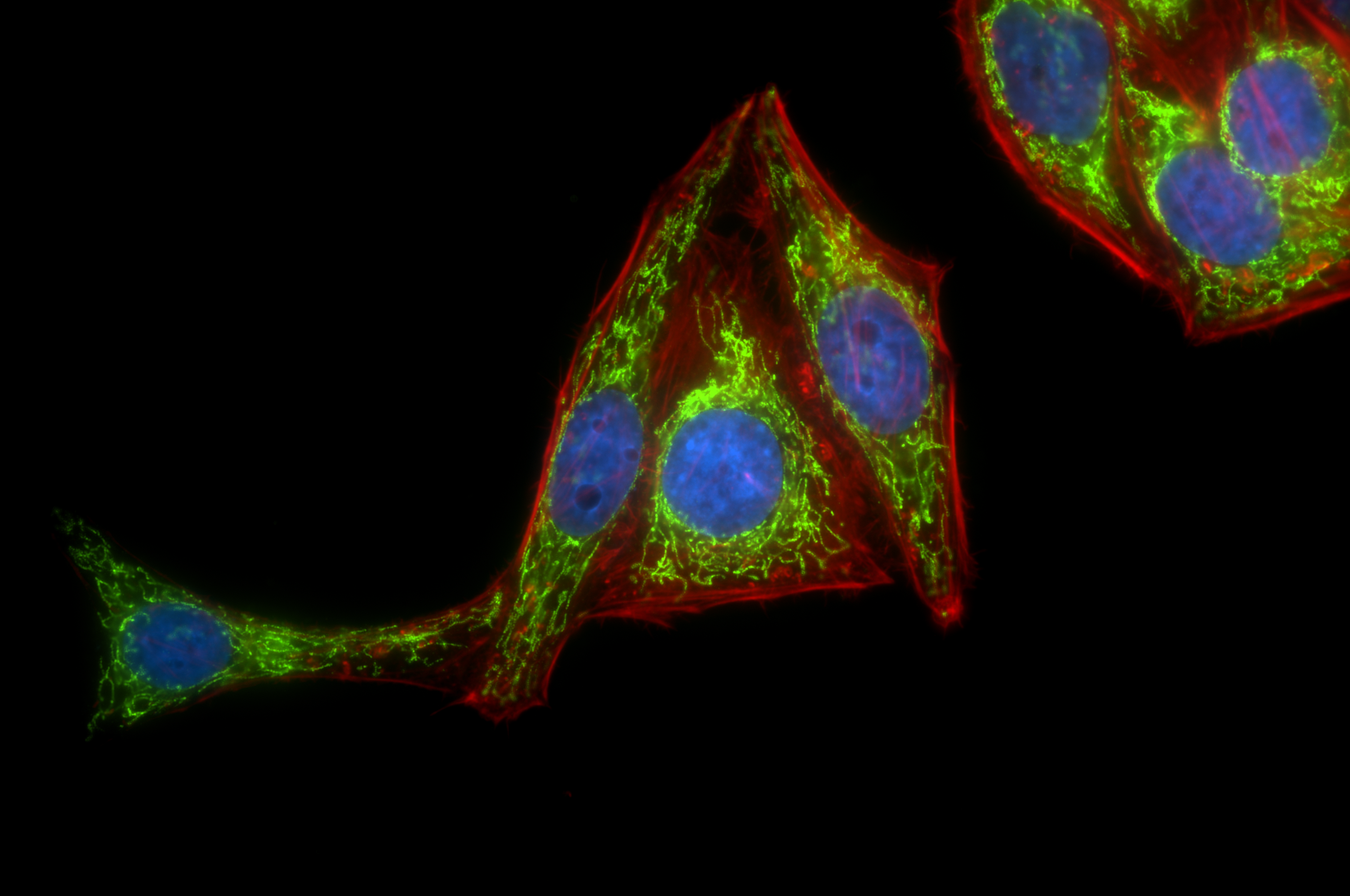 IF Staining of HepG2 using 86174-2-RR (same clone as 86174-2-PBS)