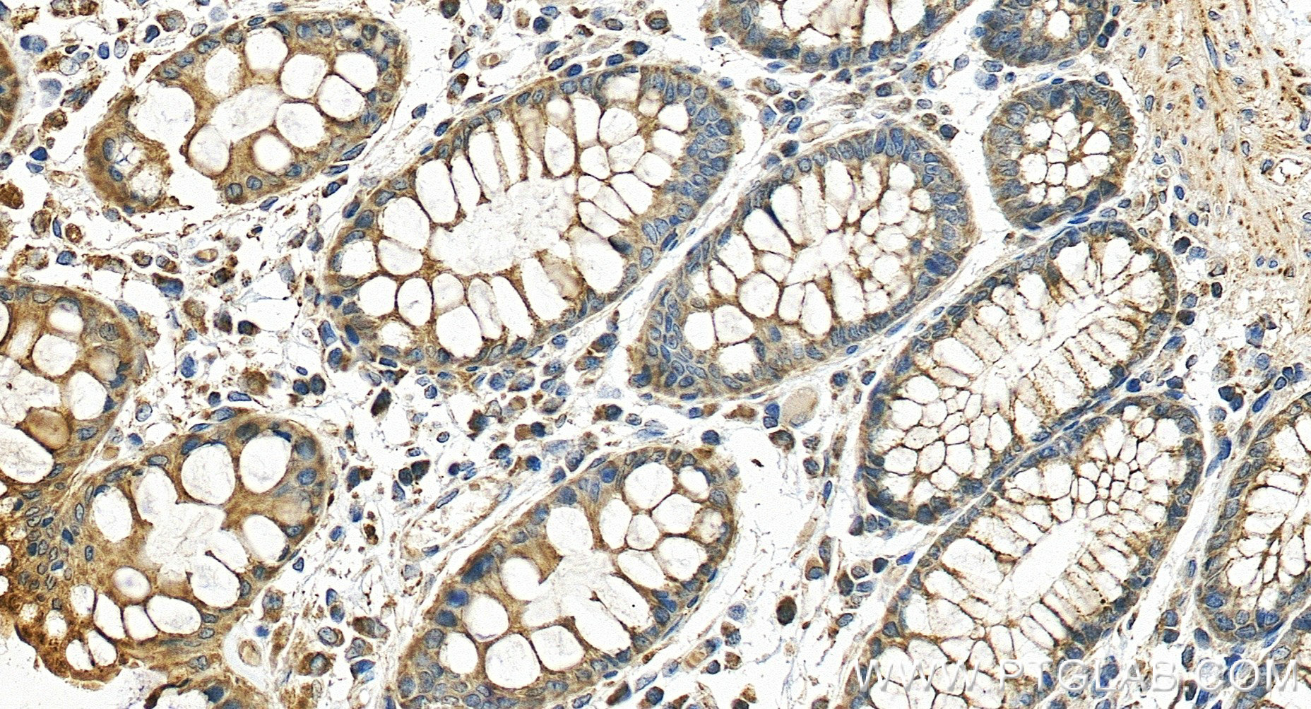 IHC staining of human colon using 86218-2-RR
