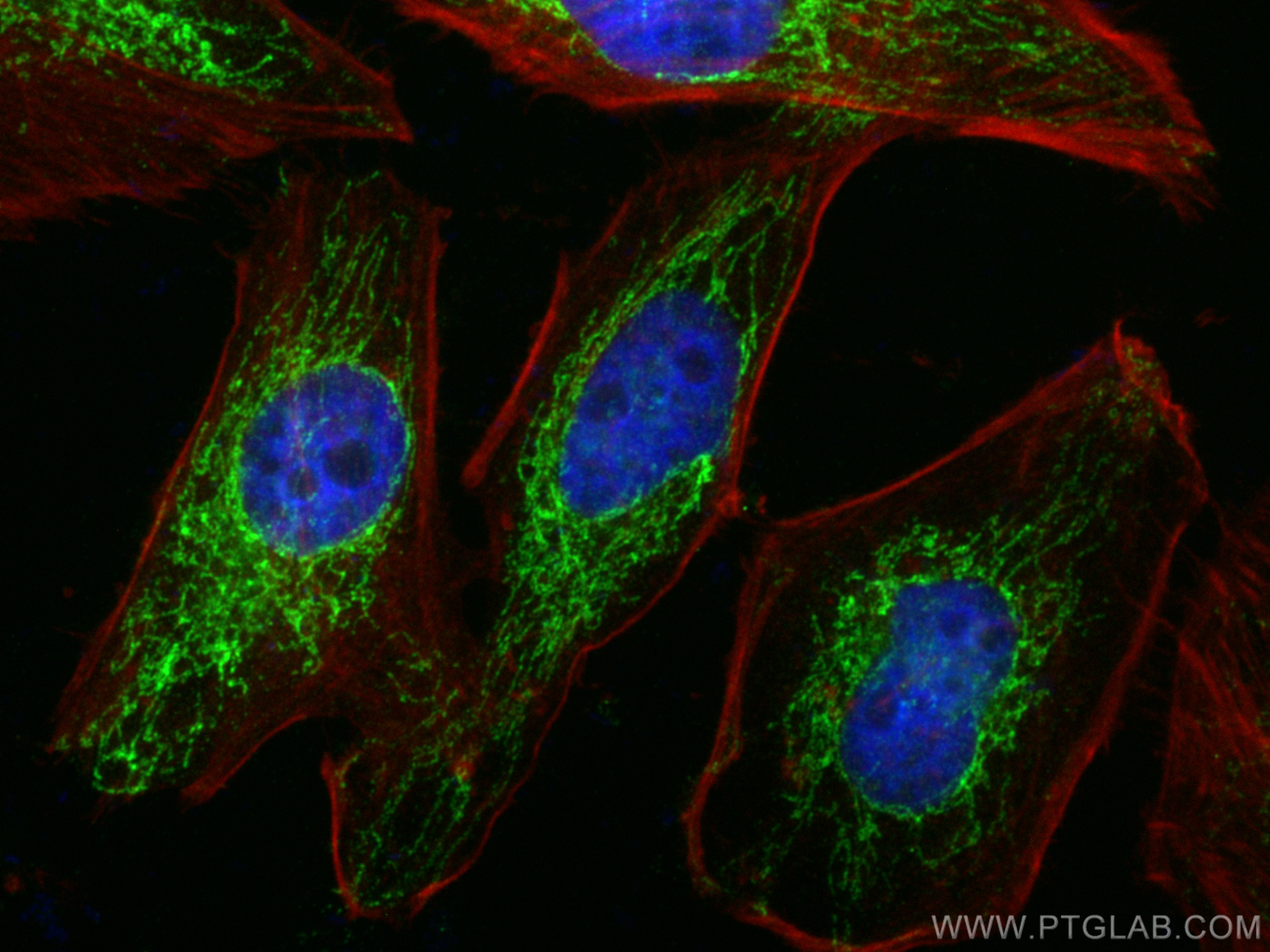 IF Staining of HeLa using 14114-1-AP