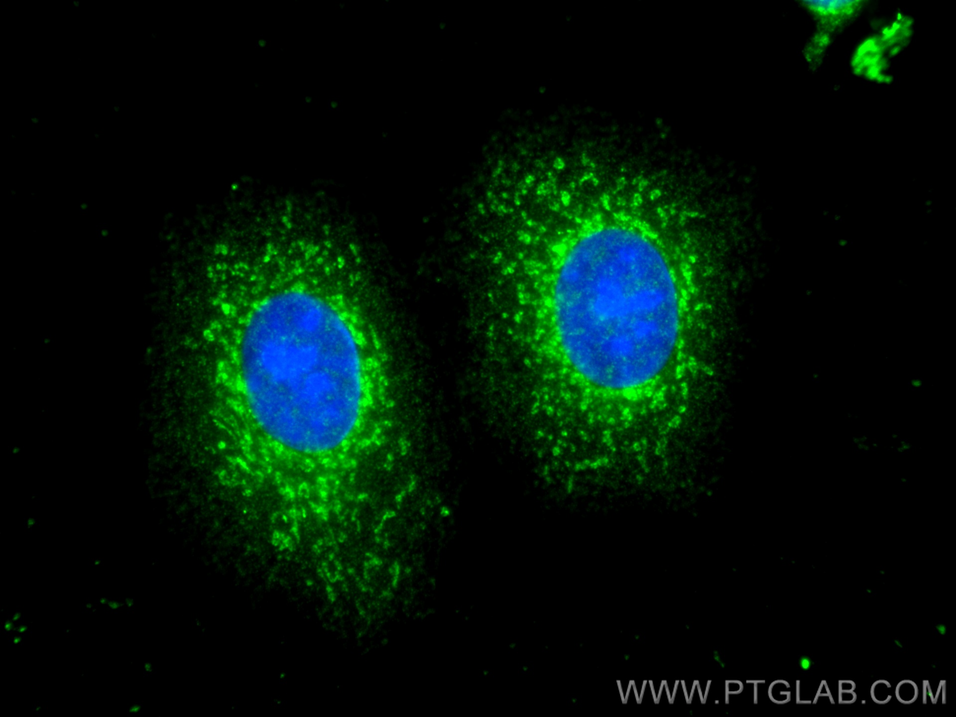 IF Staining of MCF-7 using 68128-1-Ig (same clone as 68128-1-PBS)