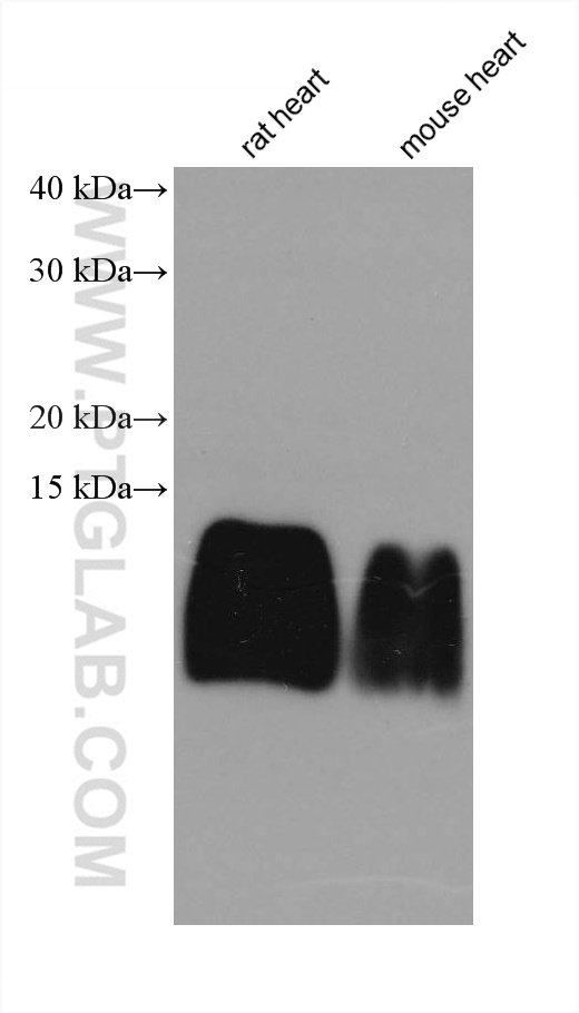 ATP5J2