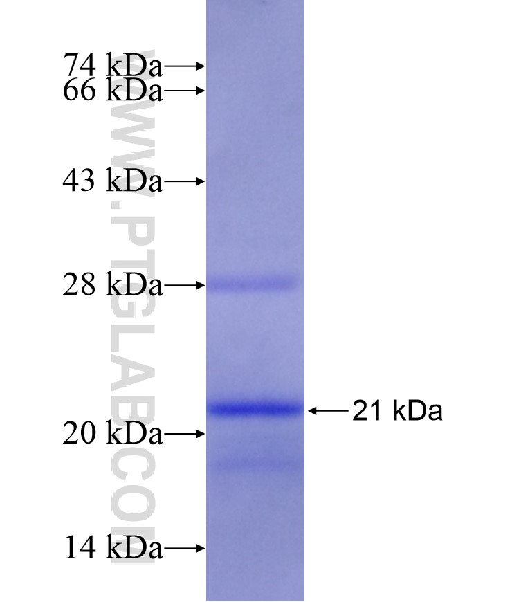 ATP5S fusion protein Ag9464 SDS-PAGE