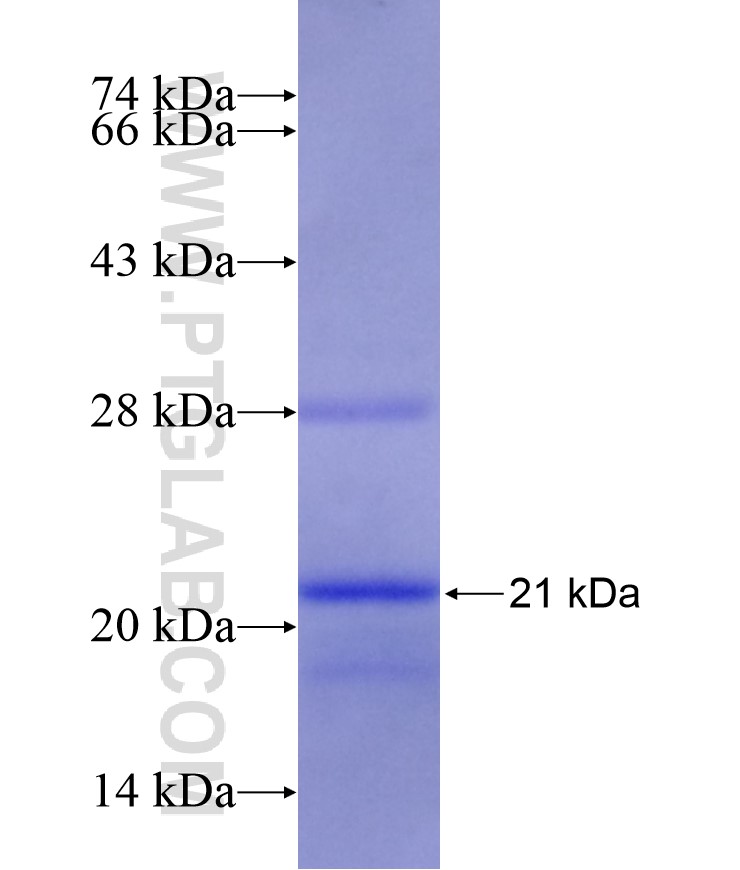 ATP5S fusion protein Ag9464 SDS-PAGE ATP5S fusion protein Ag9464 SDS-PAGE