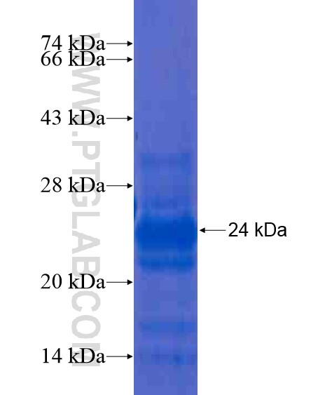 ATP5SL fusion protein Ag20909 SDS-PAGE