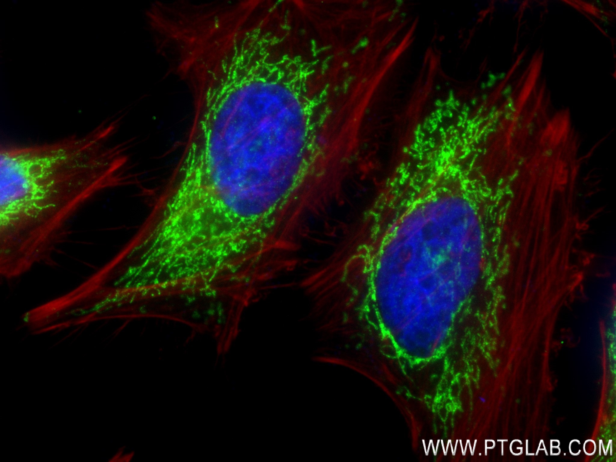 IF Staining of HeLa using 83201-3-RR