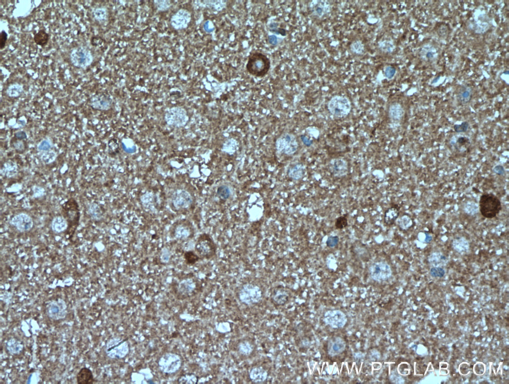 IHC staining of mouse brain using 13828-1-AP