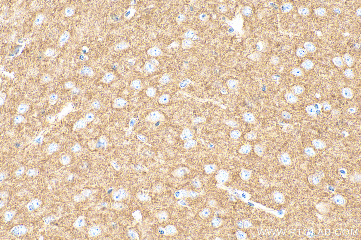 IHC staining of mouse brain using 13828-1-AP