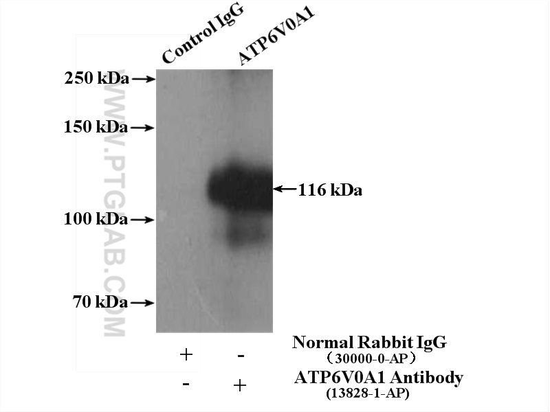 IP experiment of mouse brain using 13828-1-AP