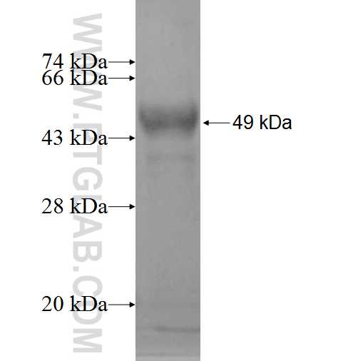 ATP6V0A2 fusion protein Ag9554 SDS-PAGE