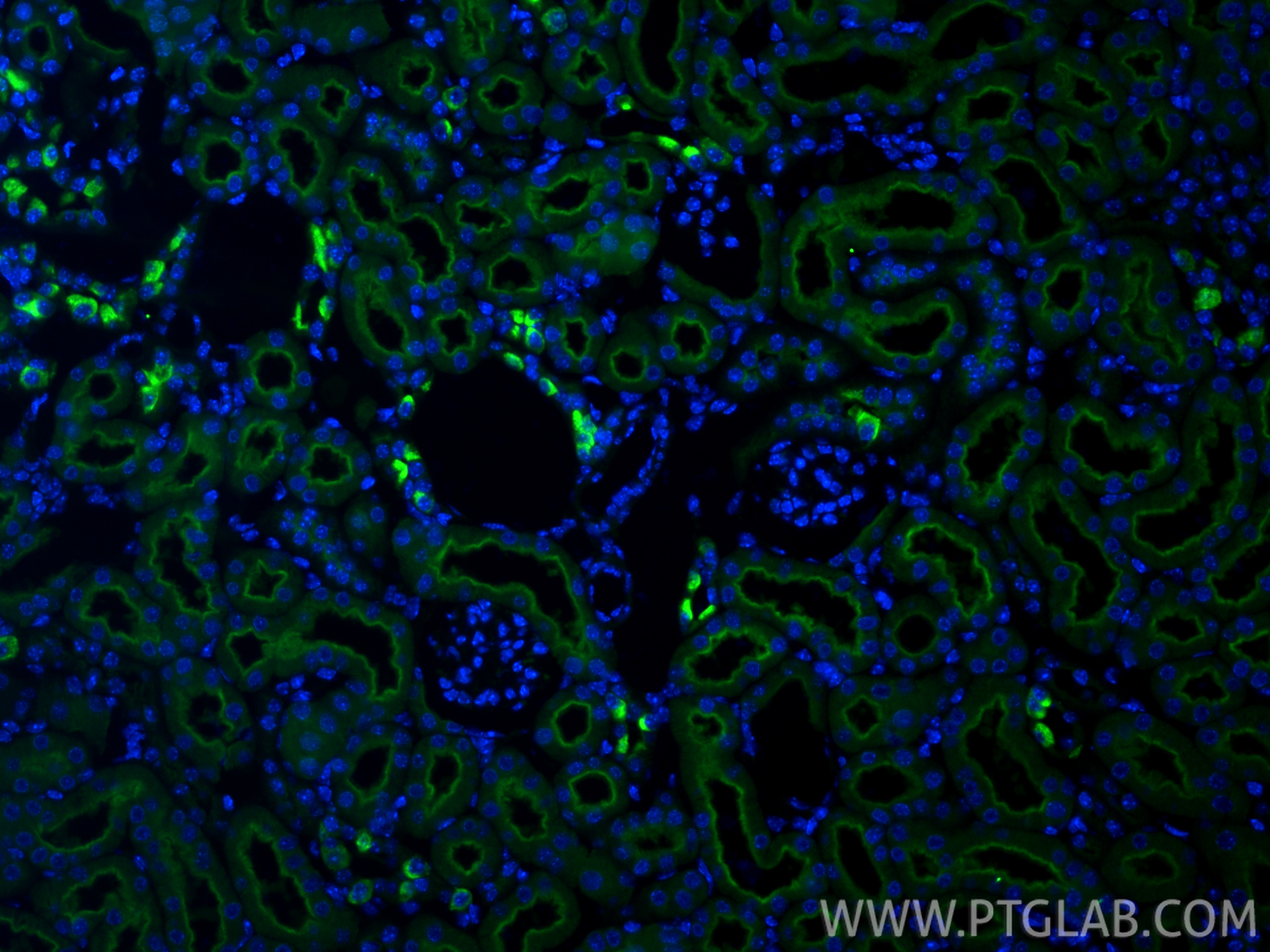 IF Staining of mouse kidney using 21570-1-AP