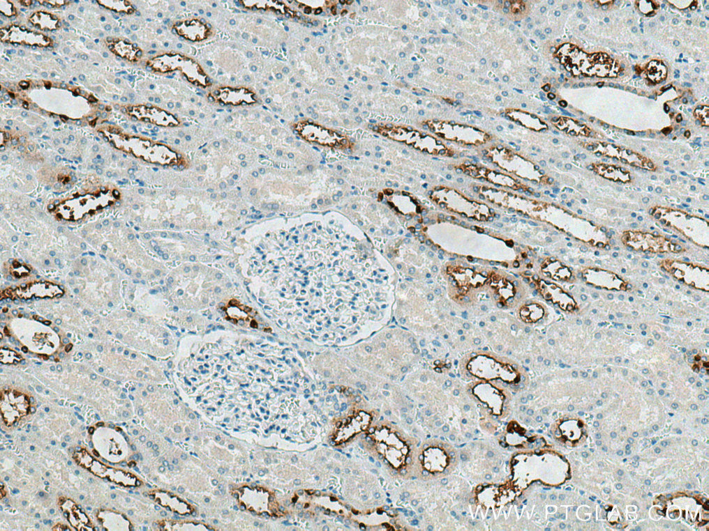 IHC staining of human kidney using 21570-1-AP