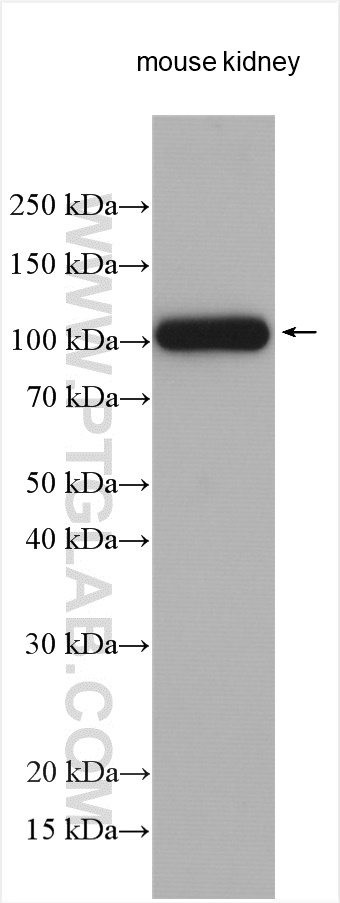 WB analysis using 21570-1-AP