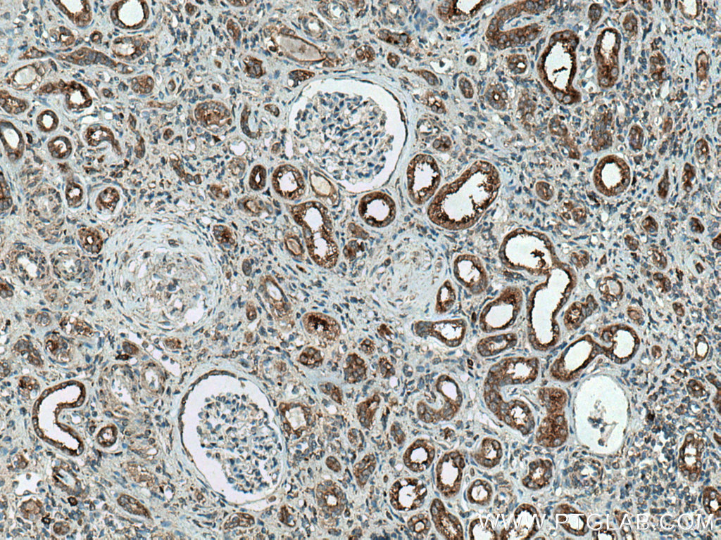 IHC staining of human kidney using 18274-1-AP