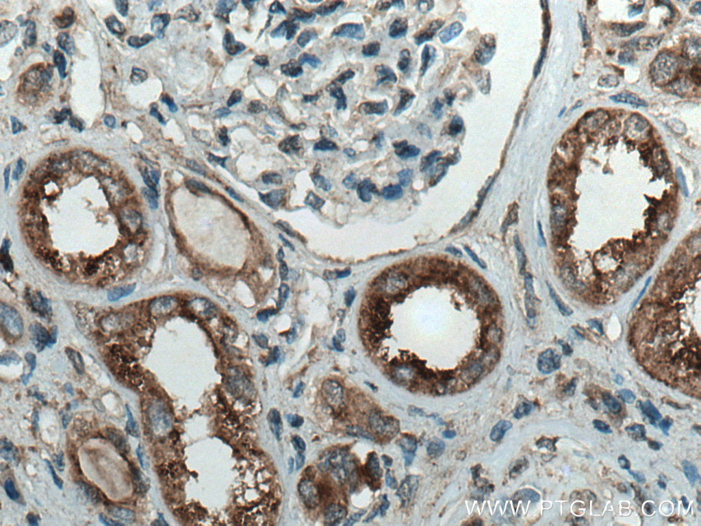 IHC staining of human kidney using 18274-1-AP