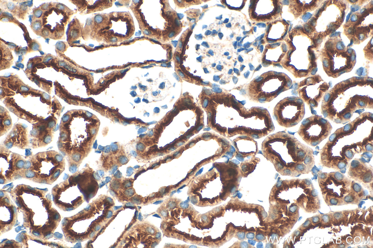 IHC staining of mouse kidney using 18274-1-AP