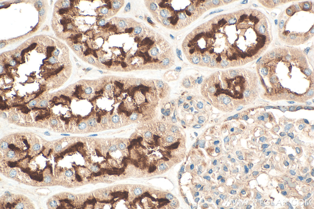 IHC staining of human kidney using 18274-1-AP