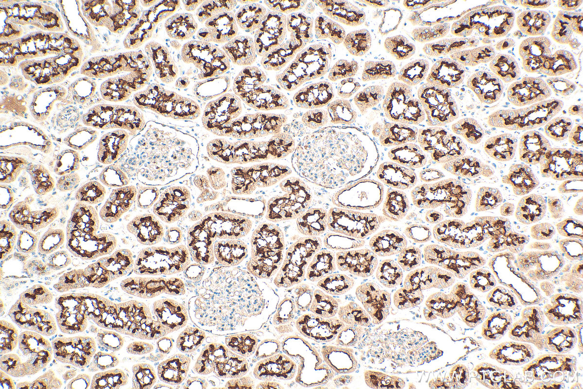 IHC staining of human kidney using 18274-1-AP