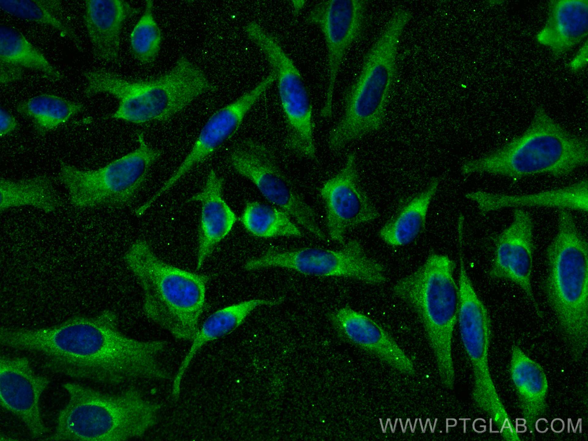 IF Staining of HeLa using 68506-1-Ig