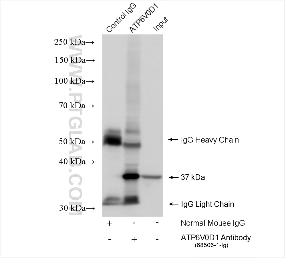 IP experiment of HeLa using 68506-1-Ig