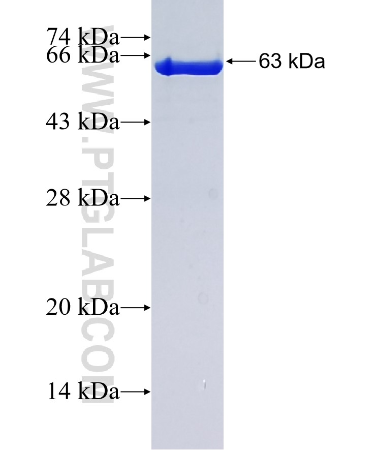 ATP6V0D2 fusion protein Ag5879 SDS-PAGE