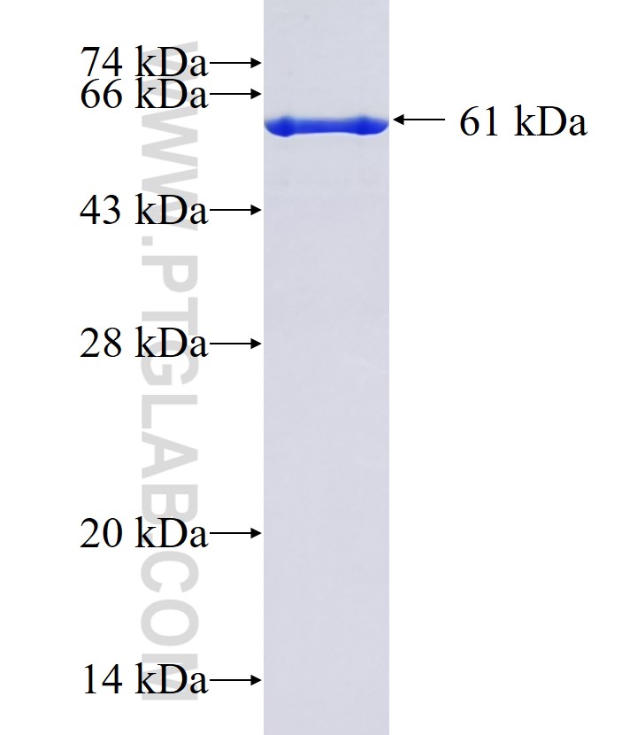 ATP6V0D2 fusion protein Ag5879 SDS-PAGE