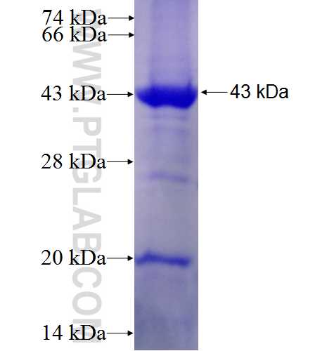 ATP6V0D2 fusion protein Ag6093 SDS-PAGE ATP6V0D2 fusion protein Ag6093 SDS-PAGE