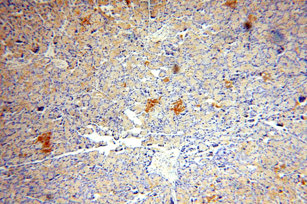 IHC staining of human pancreas using 17115-1-AP