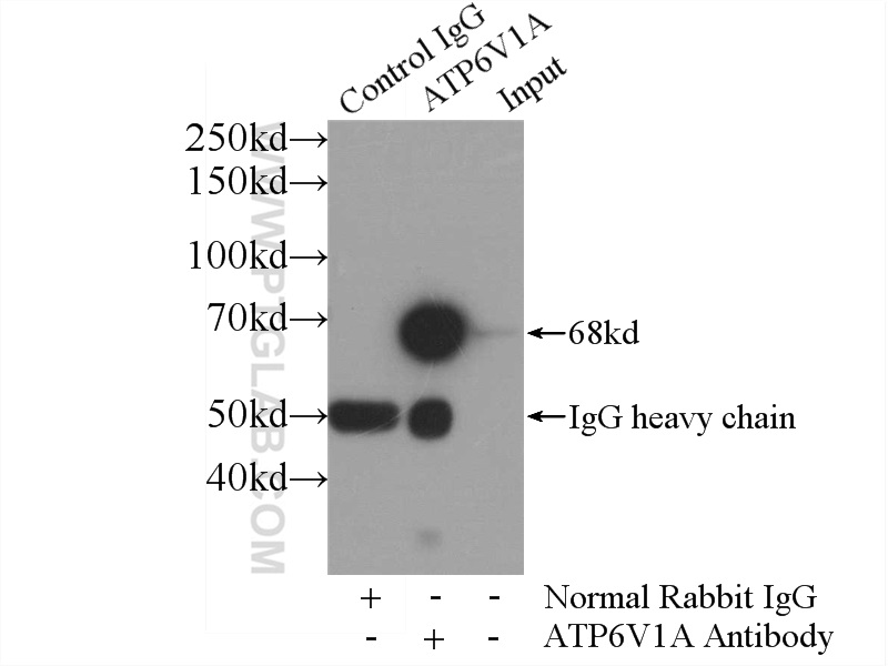 IP experiment of HeLa using 17115-1-AP