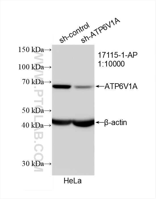 WB analysis of HeLa using 17115-1-AP