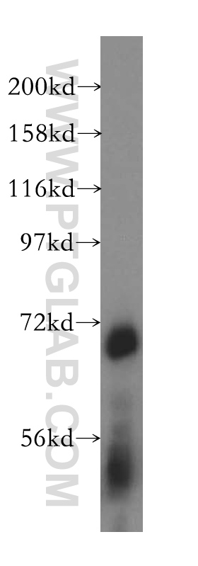 ATP6V1A