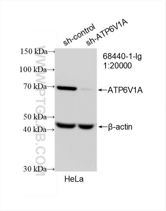 WB analysis of HeLa using 68440-1-Ig