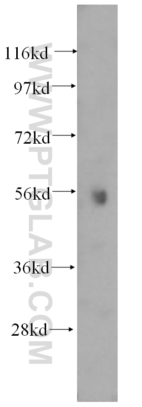 ATP6V1B1