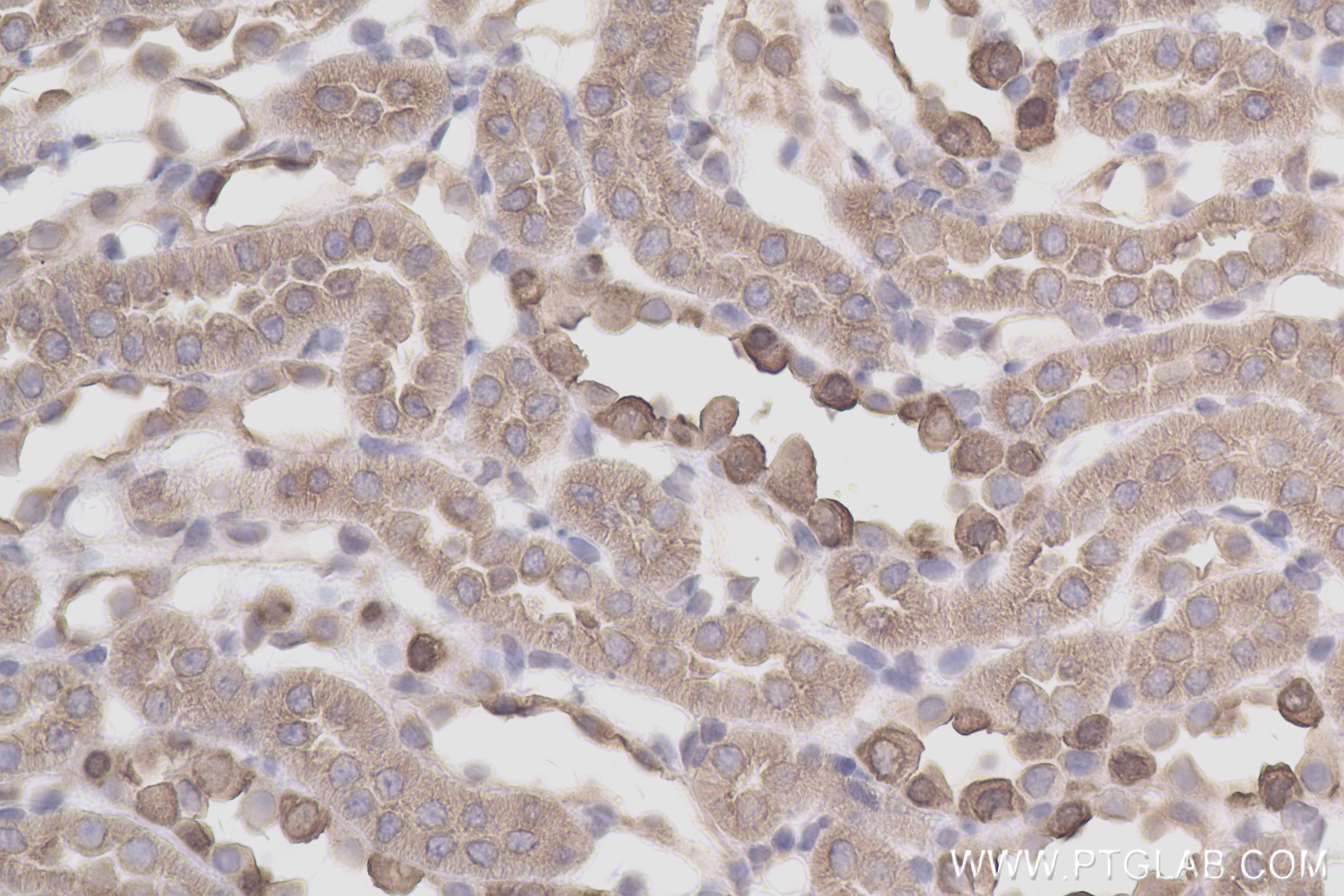 IHC staining of rat kidney using 83953-5-RR