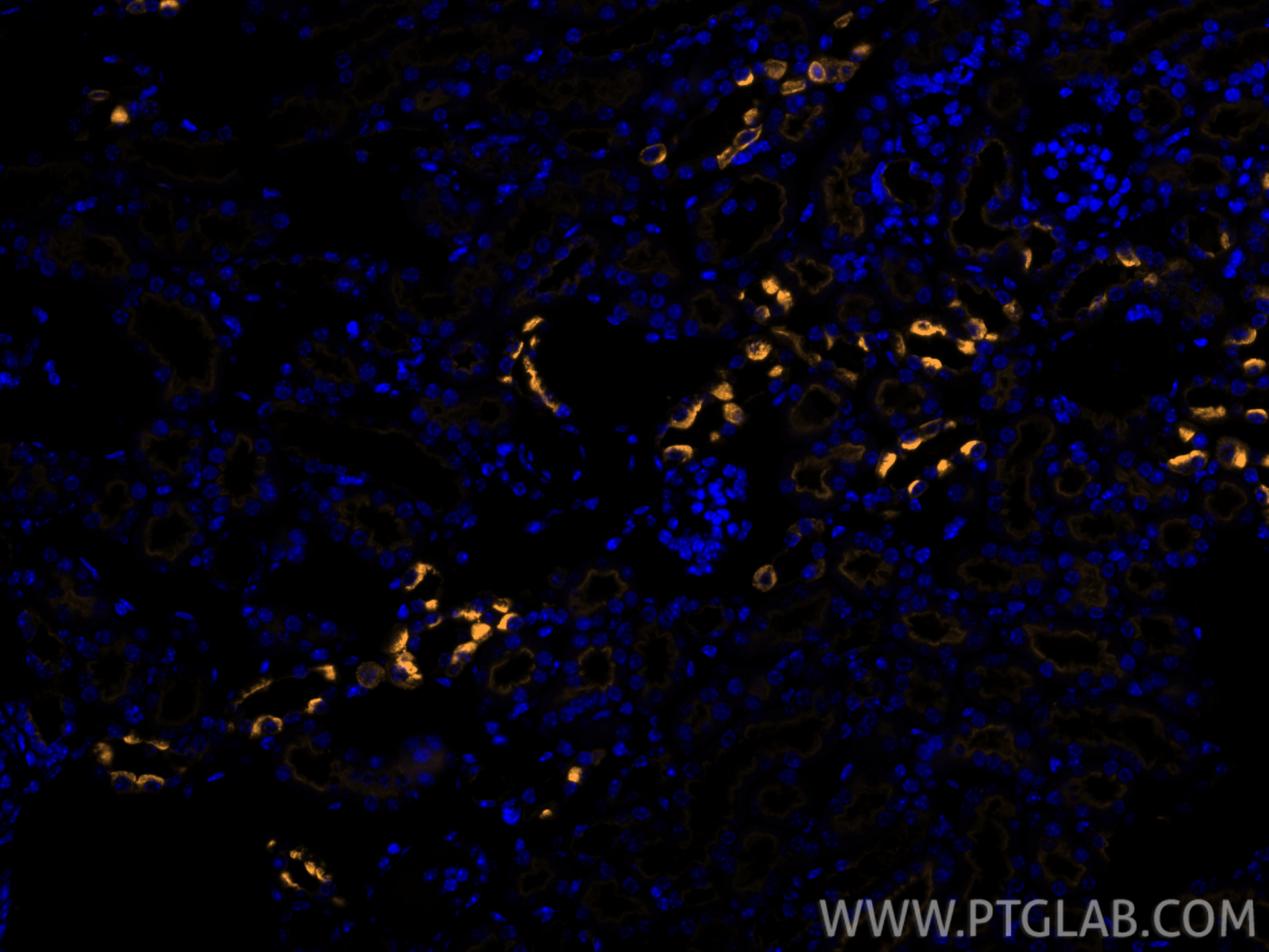 IF Staining of mouse kidney using CL555-83953-5