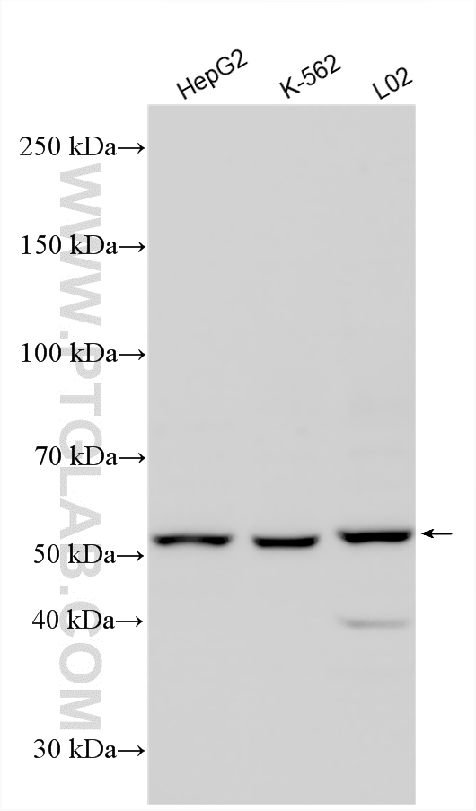 Various lysates were subjected to SDS PAGE followed by western blot with 15097-1-AP (ATP6V1B2 antibody) at dilution of 1:5000 incubated at room temperature for 1.5 hours. WB analysis using 15097-1-AP