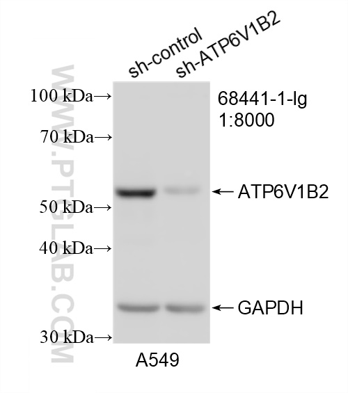 WB analysis of A549 using 68441-1-Ig