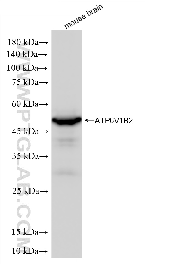 mouse brain tissue were subjected to SDS PAGE followed by western blot with <a class='green' href='/productredirect?CatalogNo=87302-4-RR' target='_blank'>87302-4-RR</a> (ATP6V1B2 antibody) at dilution of 1:10000 incubated at room temperature for 1.5 hours. This data was developed using the same antibody clone with 87302-4-PBS in a different storage buffer formulation. WB analysis of mouse brain using 87302-4-RR (same clone as 87302-4-PBS)