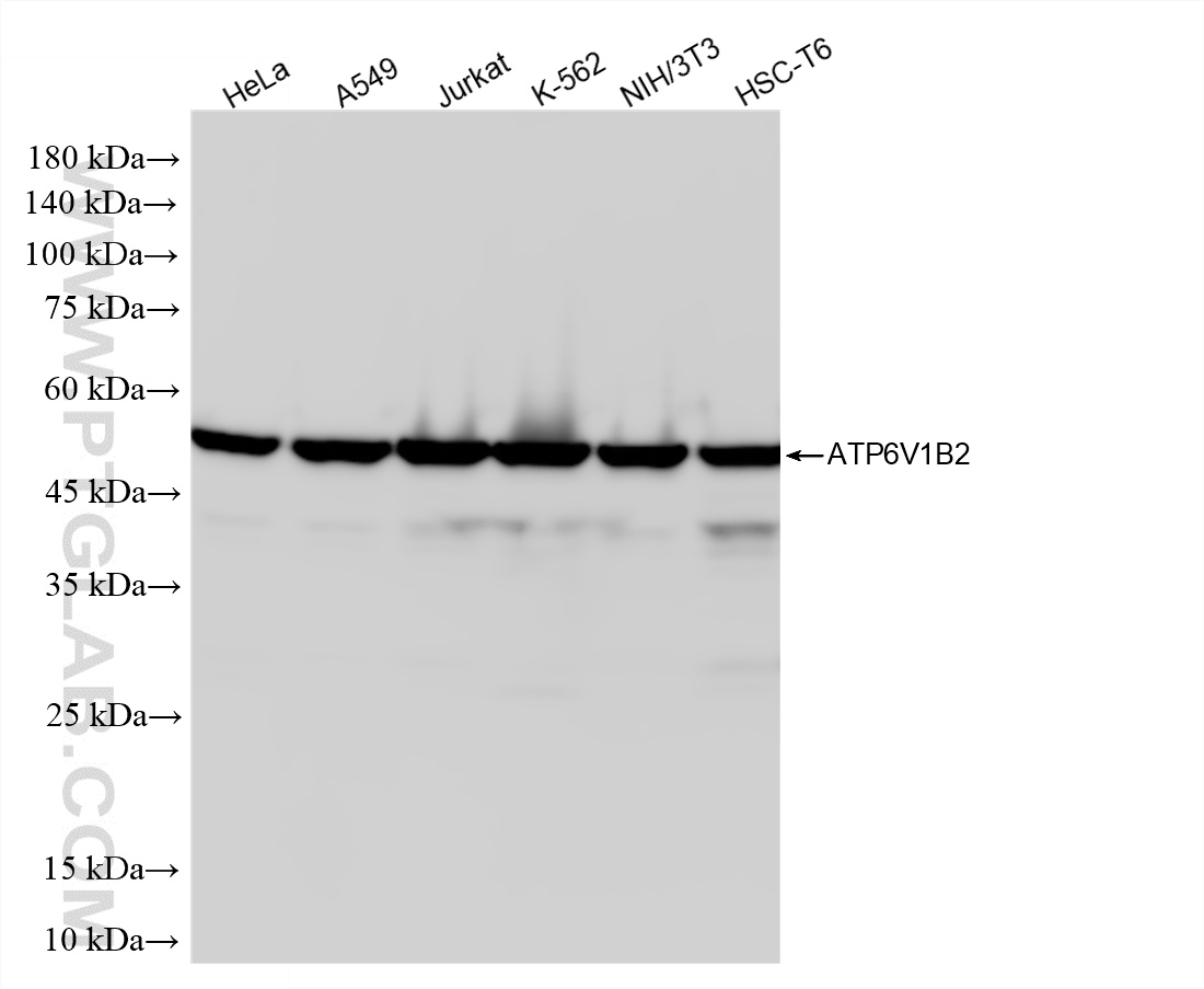 Various lysates were subjected to SDS PAGE followed by western blot with <a class='green' href='/productredirect?CatalogNo=87302-4-RR' target='_blank'>87302-4-RR</a> (ATP6V1B2 antibody) at dilution of 1:10000 incubated at room temperature for 1.5 hours. This data was developed using the same antibody clone with 87302-4-PBS in a different storage buffer formulation. WB analysis using 87302-4-RR (same clone as 87302-4-PBS)