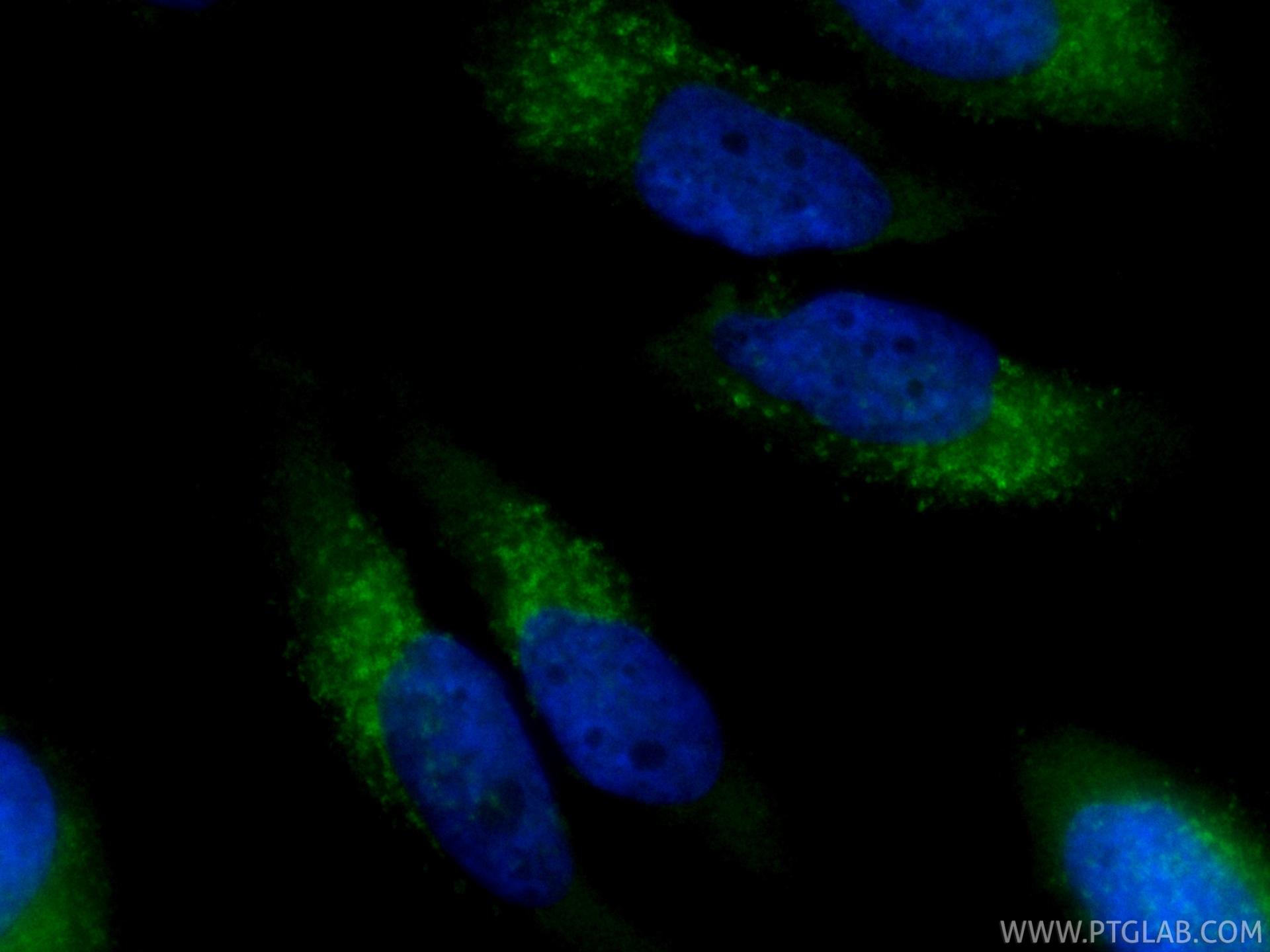 IF Staining of HeLa using CL488-87302-4 IF Staining of HeLa using CL488-87302-4