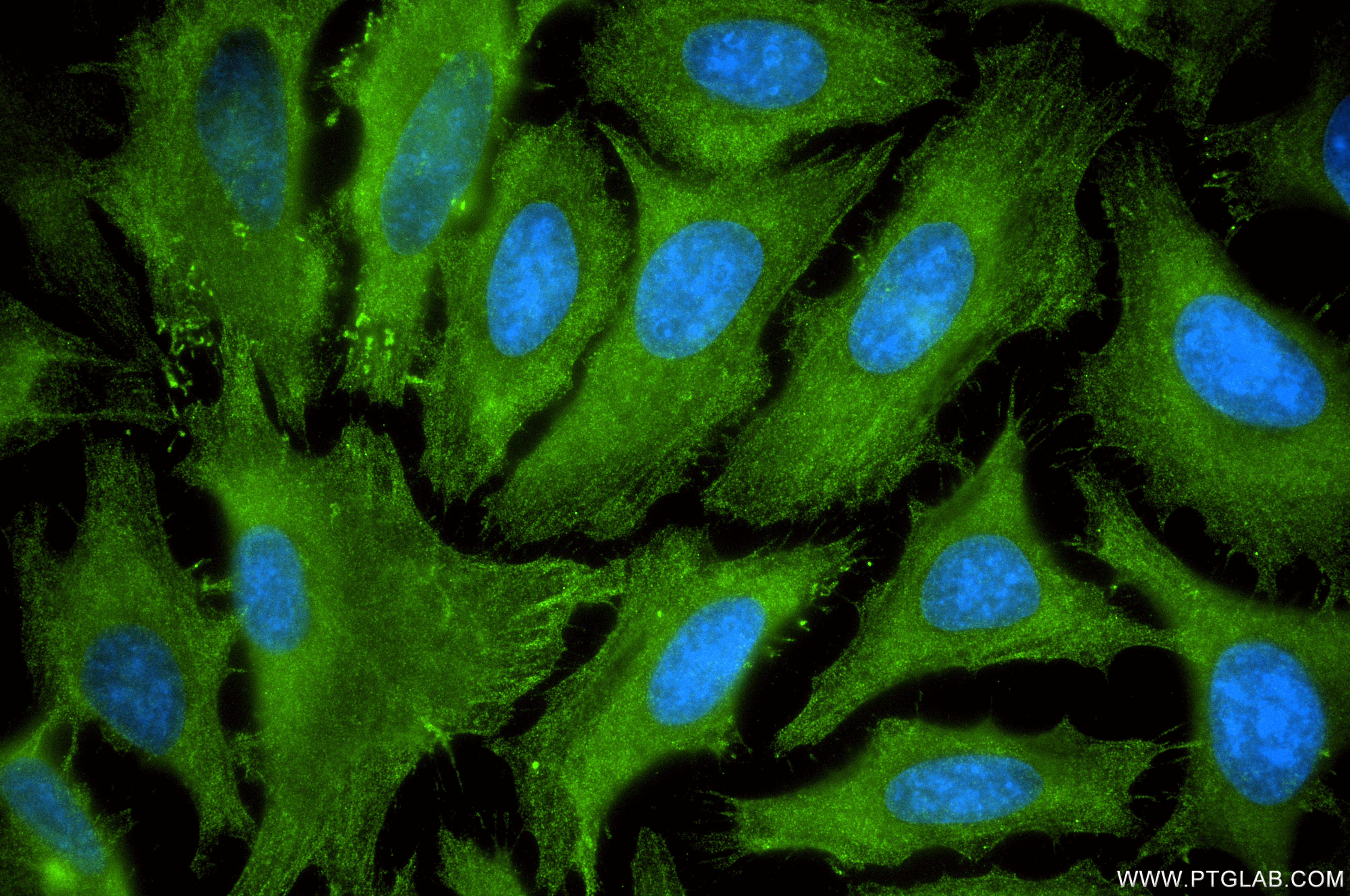 IF Staining of HeLa using 86345-2-RR