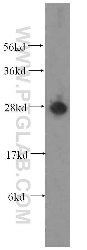 ATP6V1D