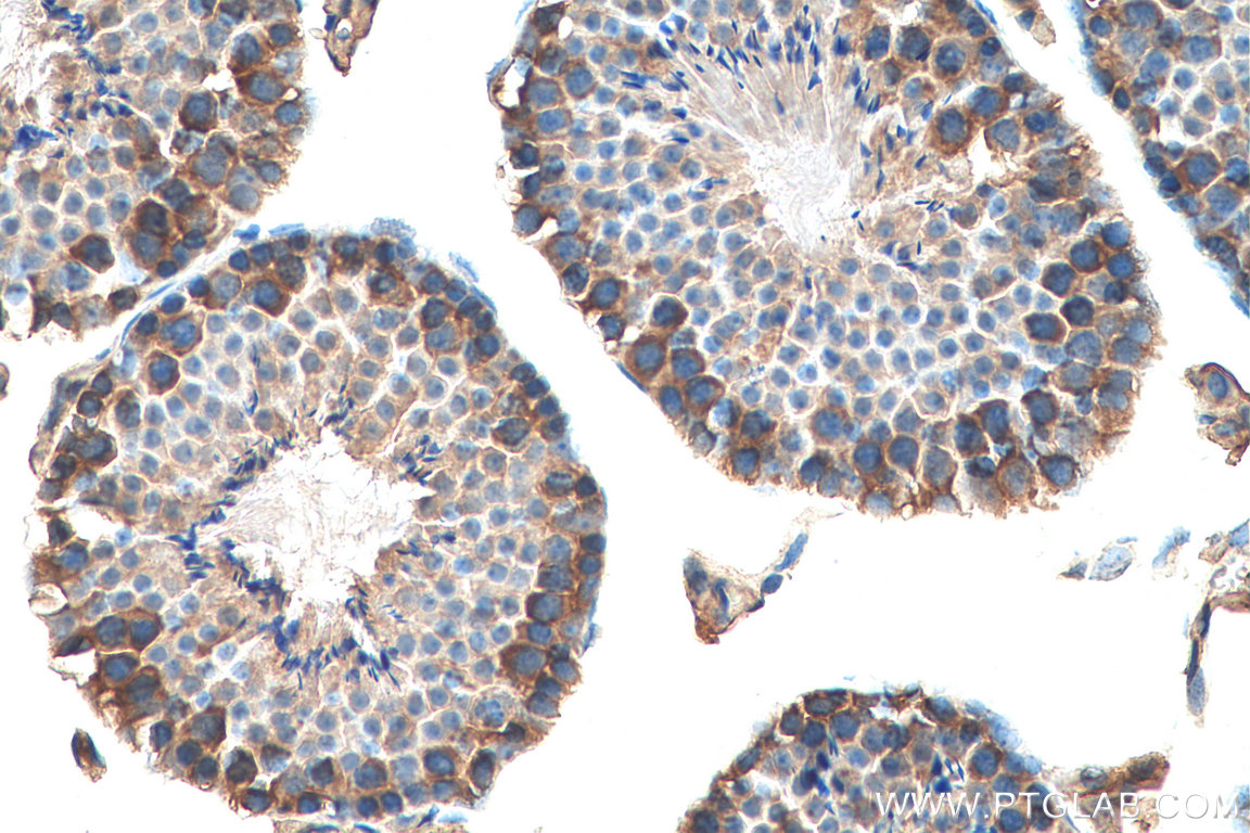 IHC staining of mouse testis using 15280-1-AP