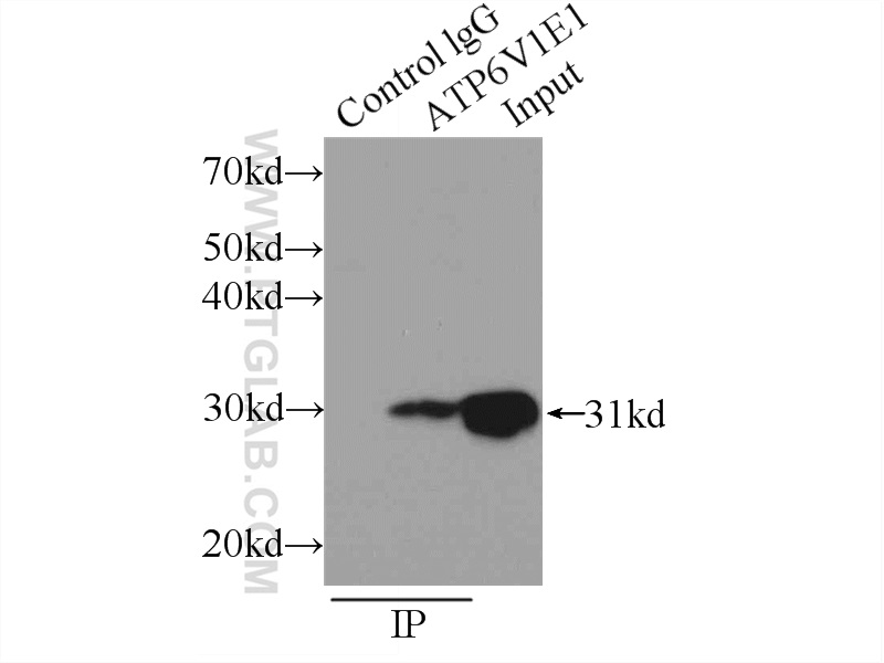 IP experiment of mouse brain using 15280-1-AP