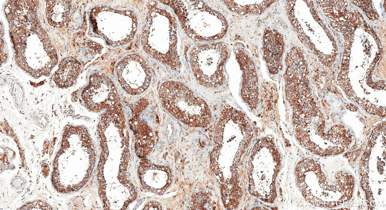 IHC staining of human testis using 83636-6-RR (same clone as 83636-6-PBS) IHC staining of human testis using 83636-6-RR (same clone as 83636-6-PBS)