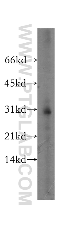 ATP6V1E2